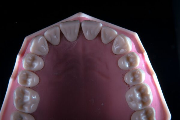 Find Endodontist in Winchester VA: Complete Guide to the Best Endodontist in Winchester, VA