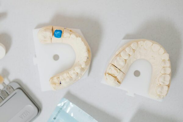 Dental Crown Services Winchester VA: Your Complete Guide to Restoring Your Smile